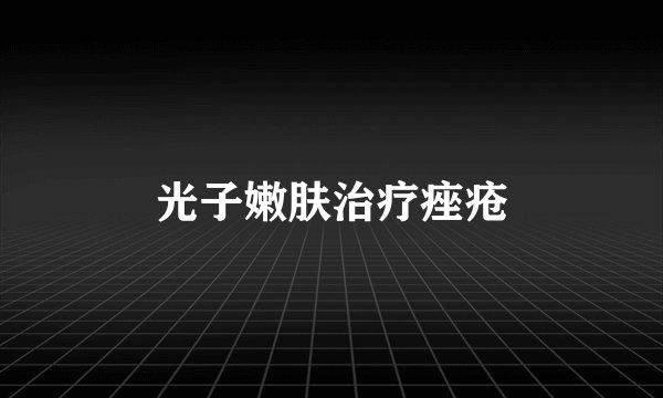 光子嫩肤治疗痤疮