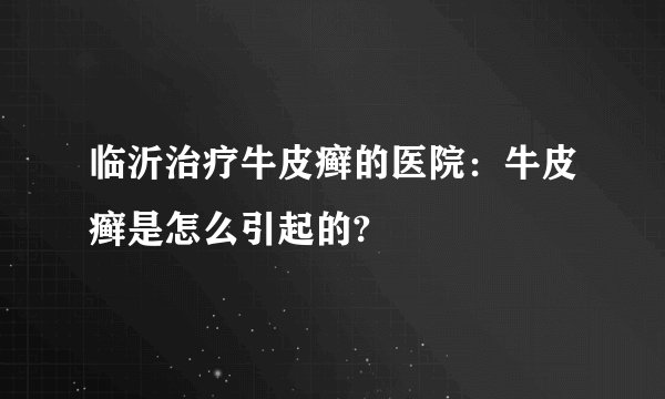 临沂治疗牛皮癣的医院:牛皮癣是怎么引起的?