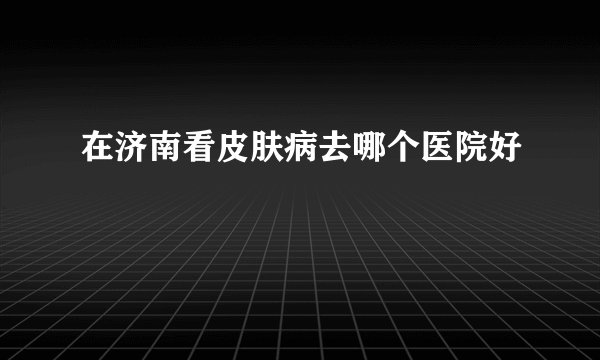 在济南看皮肤病去哪个医院好