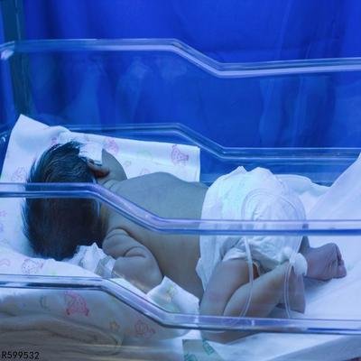 如何预防新生儿胆红素脑病