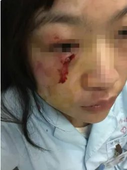 成都护士为什么被患者家属打伤?