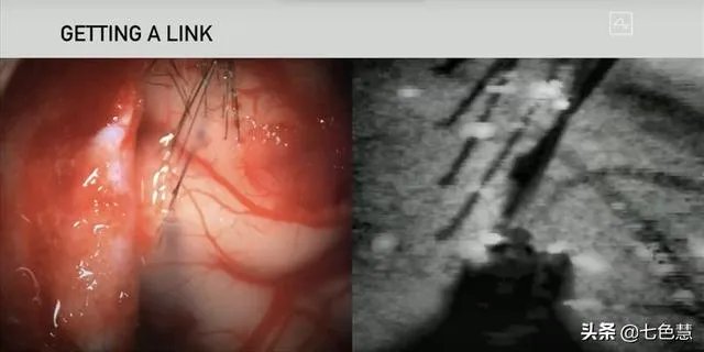马斯克用猪展示Neuralink脑机接口设备有哪些亮点?