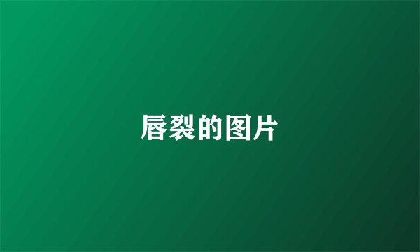 唇裂的图片