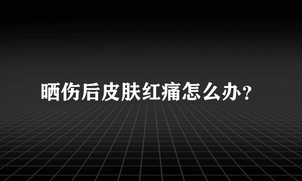 晒伤后皮肤红痛怎么办？
