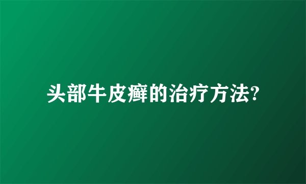 头部牛皮癣的治疗方法?