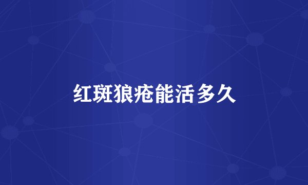 红斑狼疮能活多久