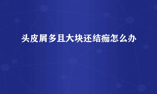 头皮屑多且大块还结痂怎么办