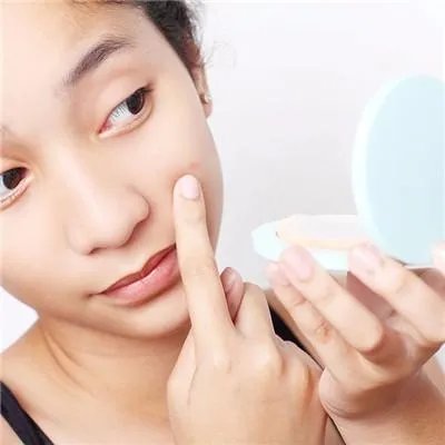 怎么去除脸上痘坑