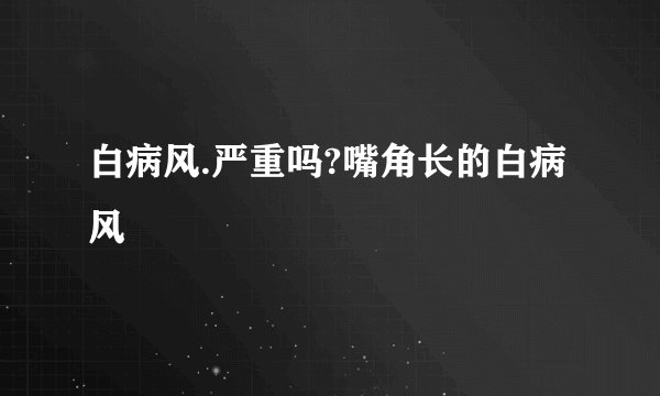 白病风.严重吗?嘴角长的白病风