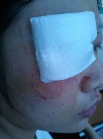 成都护士为什么被患者家属打伤?