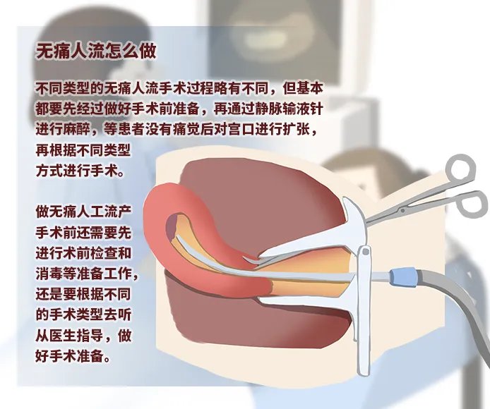 无痛人流怎么做