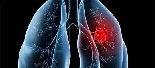 肺癌晚期临死前症状?