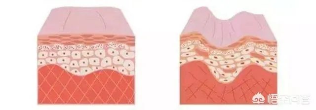 美容仪真的有返老还童的效果吗?