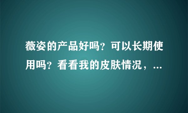 薇姿的产品好吗?可以长期使用吗?看看我的皮肤情况,还有更适合我的产品吗?