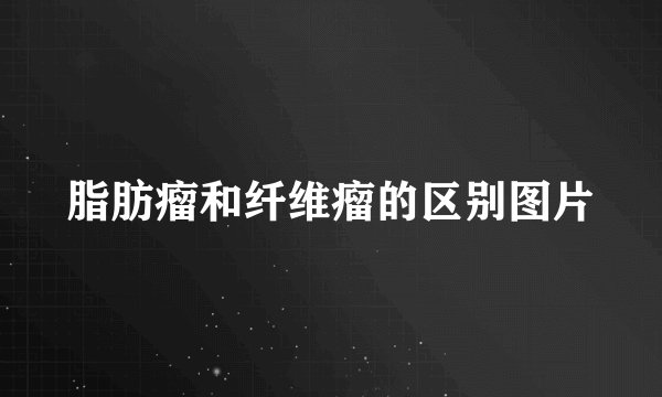脂肪瘤和纤维瘤的区别图片