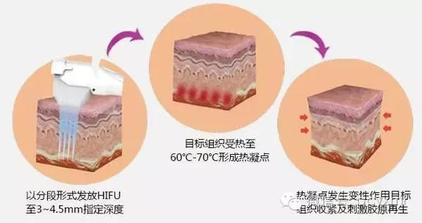 美容仪真的有返老还童的效果吗?