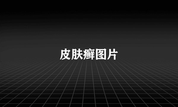 皮肤癣图片