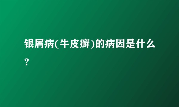 银屑病(牛皮癣)的病因是什么？