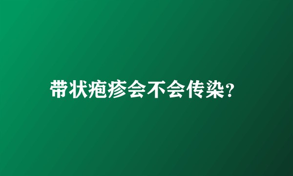 带状疱疹会不会传染？